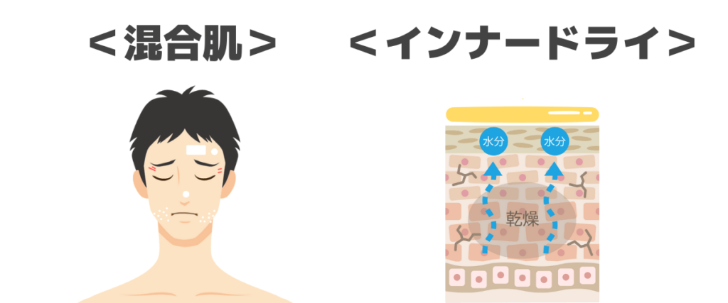 混合肌とインナードライの図解