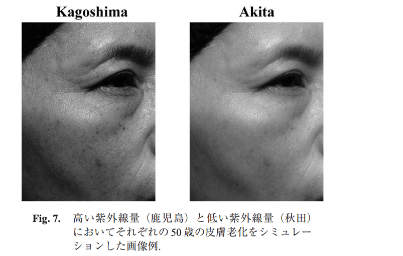 光老化における肌のシミュレーション画像