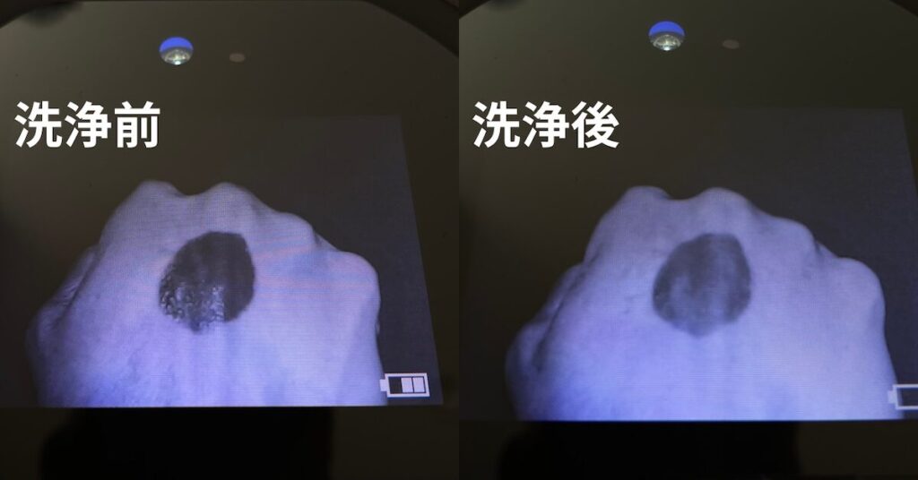 日焼け止めが洗顔で落ちるかの検証結果